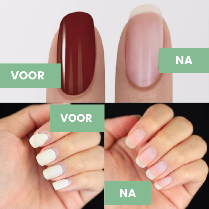 Magische nagellakverwijderaar | 1+1 GRATIS